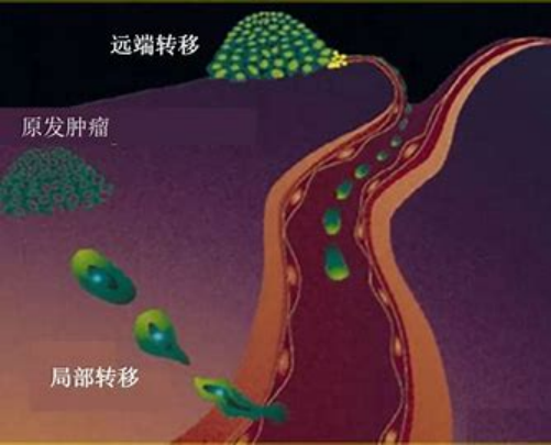 1688211408580081.png CTC轉(zhuǎn)移圖示.png
